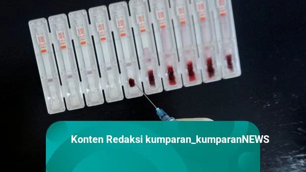 Sepanjang Januari-Agustus 2022, 554 Orang Terdeteksi Positif HIV di Kota Bekasi