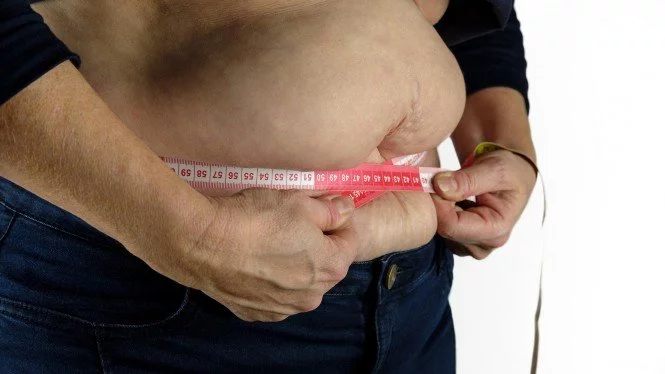 10 Risiko Obesitas, Kelebihan Lemak Bisa Bahaya Bagi Tubuh