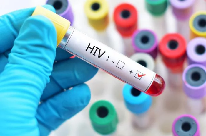 Kasus HIV/AIDS di Gresik Meningkat, Hubungan Sesama Jenis Penyumbang Terbanyak
