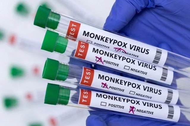 Indonesia Siap Berikan Vaksin Cacar Monyet Ini, Siapa yang Berhak?