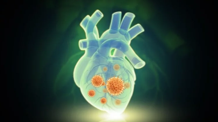 Dokter Spesialis Jantung: Kurang Bergerak Bisa Tingkatkan Risiko Gangguan Jantung