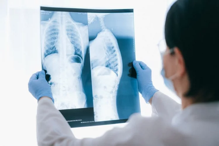 Dokter: Tiga langkah hidup sehat untuk jaga kesehatan paru-paru
