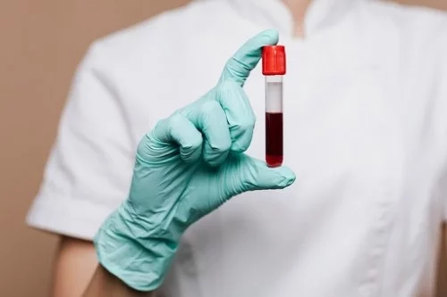 Wow, Para Ilmuwan Temukan Golongan Darah Baru, Apa Itu?