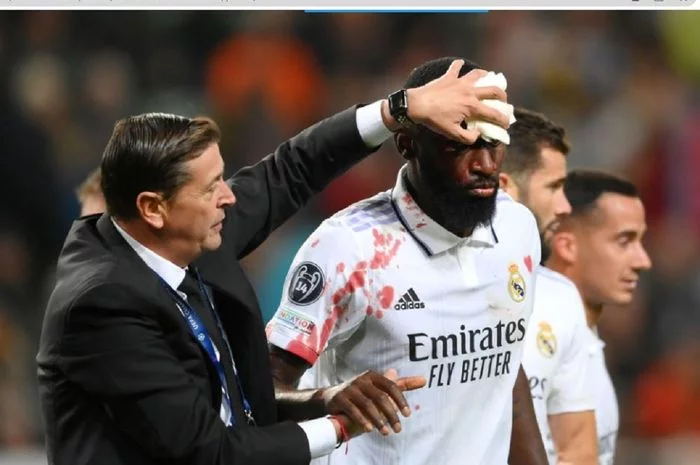 Aksi Heroik Antonio Ruediger, Cetak Gol hingga Berdarah demi Selamatkan Real Madrid dari Kekalahan