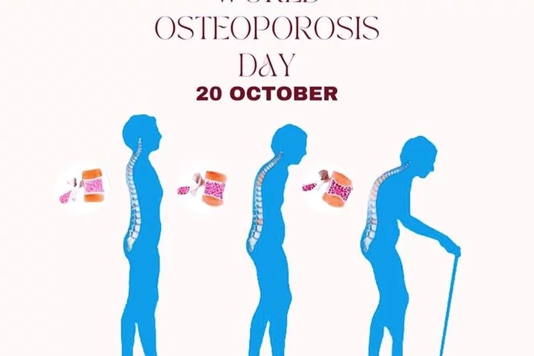 Tanggal 20 Oktober Hari Memperingati Apa? Ada Hari Osteoporosis Sedunia dan Peristiwa Lain