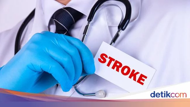 Kenali Gejala, Penyebab, dan Fakta Tentang Stroke