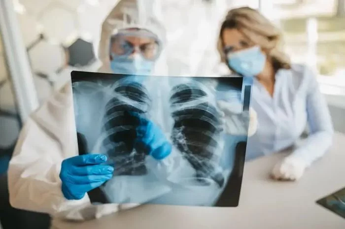 Pneumonia Disebut Sebagai Pandemi yang Terlupakan, Kenali Risiko Pneumonia di Lingkungan Pekerja