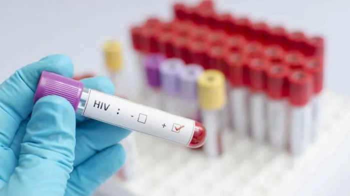 Ketahui Cara Penularan HIV Lengkap dengan Pencegahannya