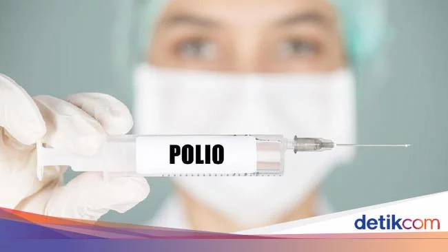 Waspadai Gejala Virus Polio, Bisa Jadi Mirip Flu Biasa!