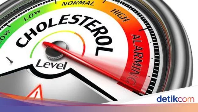 Catat! Ini Kadar Kolesterol Normal untuk Usia Muda