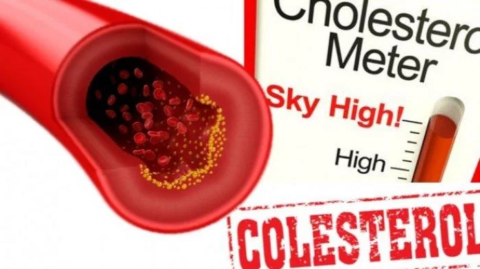 Cara Tingkatkan Kadar Kolesterol Baik Atau HDL, Bisa Bersihkan Kolesterol Jahat di Tubuh