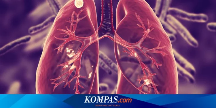 3 Penyebab Paru-paru Basah yang Utama Halaman all