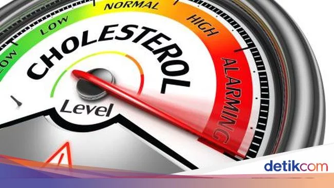Gejala Kolesterol Tinggi Tak Biasa, Harus Waspada Jika Muncul Keluhan Ini
