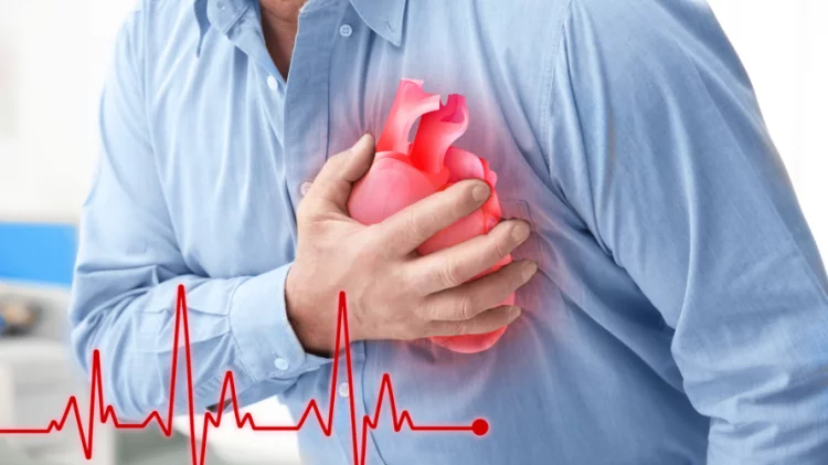 Serangan Jantung Stemi: Gejala, Penyebab, dan Cara Mengatasi