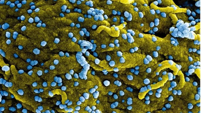 Kasus Bertambah, Pakar Peringati Penularan Virus Marburg Risiko Kematian 88 Persen