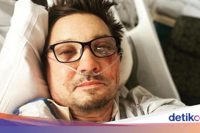 Kondisi Terkini Jeremy Renner, 2 Bulan Usai Kecelakaan Maut