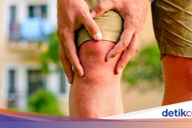 Kaki Bengkak dan Terasa Panas, Apakah Efek Samping dari Obat Hipertensi Dok?