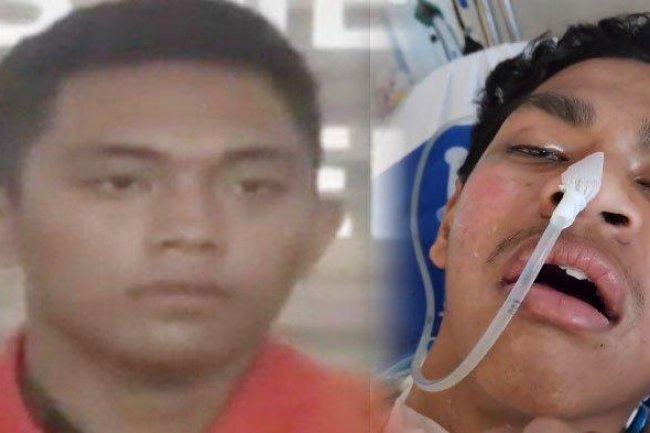 AKHIRNYA David Ozora Korban Penganiayaan Mario Dandy Sudah Sadar, Ini yang Tanggung Biaya Perawatan