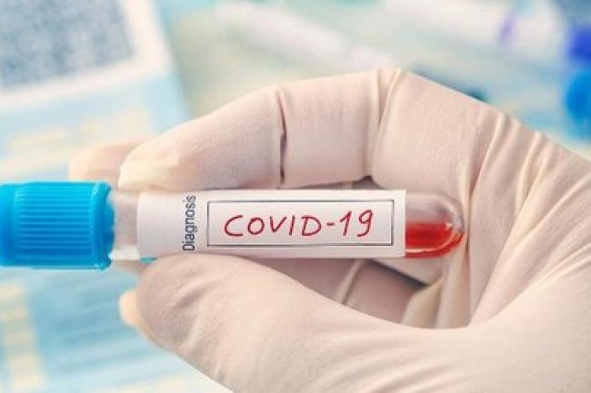 Dinkes DKI Prediksi Dua Pekan Kedepan Berpotensi Kenaikan Kasus Covid-19