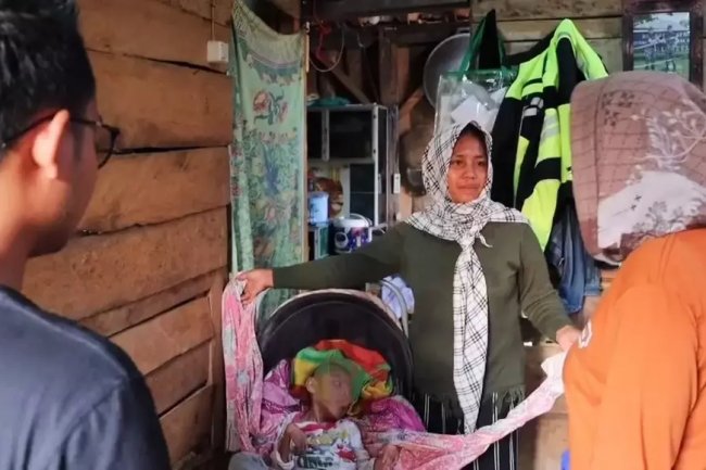 Sella, Bocah 9 Tahun di Tanggamus Menderita Kelumpuhan Otak