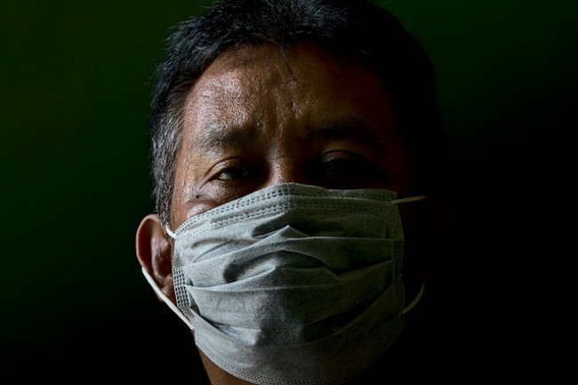 Gejala Tuberkulosis dan Cara Pengobatannya, Jangan Sepelekan Penyakit Mematikan Ini