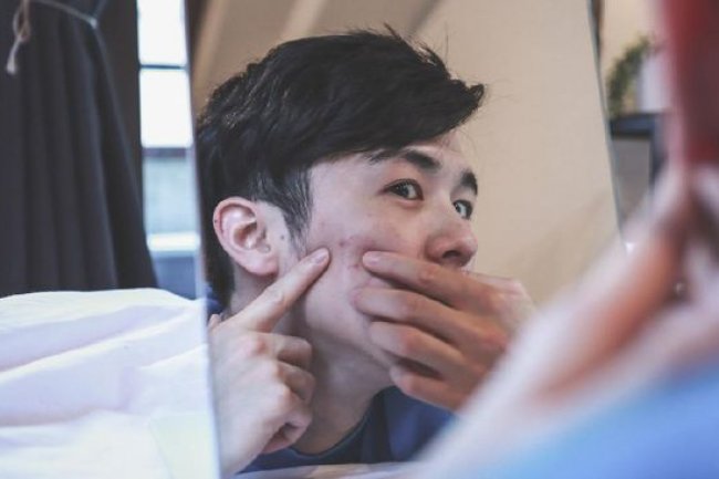 10 Jenis Masalah Kulit, Penyebab, dan Cara Mengatasinya