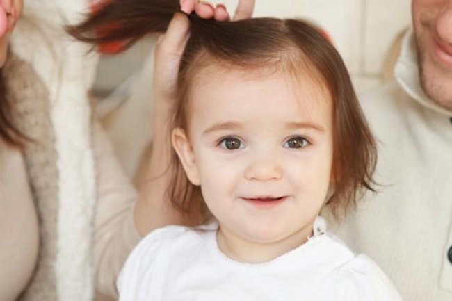 Alopecia Areata, Penyebab Rambut Anak Rontok Hingga Botak
