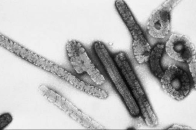 Tanzania dan Guinea Ekuatorial Terjangkit Wabah Virus Marburg, Apakah Sudah Ada Vaksinnya?