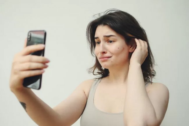 Yulia Baltschun Bagikan 3 Tips Meredakan Jerawat Parah, Salah Satunya ke Dokter Kandungan Lho