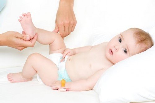 Penyebab Bayi Mengalami Ruam Popok dan Cara Mengobatinya