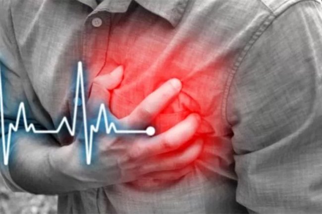 Mengenal LAA Closure, Tindakan Pencegah Stroke Bagi Pasien Aritimia