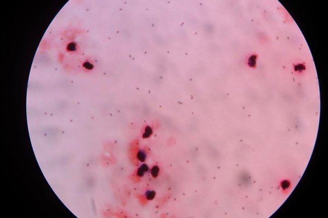 Dari Sejumlah Warga di Denpasar Terjangkit Meningitis hingga BOR Pasien COVID-19 Meningkat