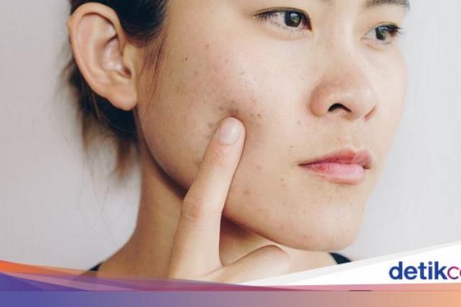 18 Jenis Penyakit Kulit yang Sering Menyerang Tubuh Manusia