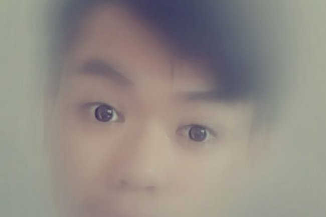 Gejala Gula Darah Tinggi yang Perlu Diwaspadai, Mata Buram Salah Satunya