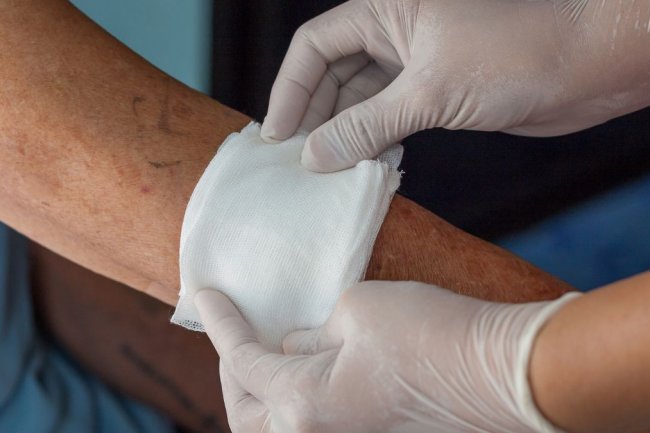 6 Cara Mengobati Luka Bernanah yang Mudah Dilakukan di Rumah