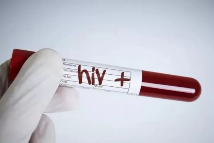 Seorang Pria Berhasil Sembuh dari HIV Setelah Jalani Transplantasi Sel Induk untuk Menyembuhkan Leukemia