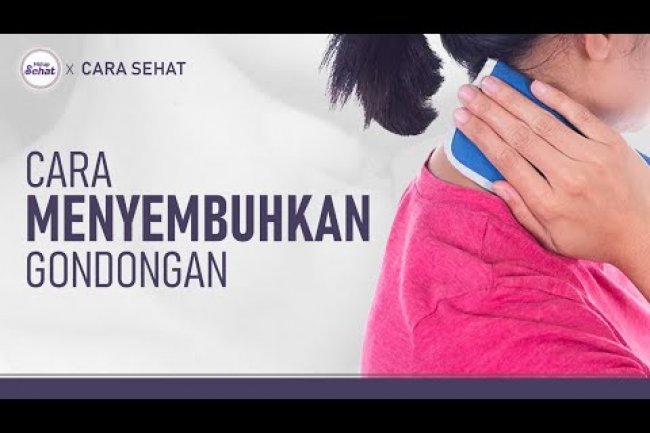 Gejala Gondongan dan Cara Mengatasinya