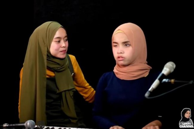 Duet Bareng Lagu Pop, Suara Lesti Kejora Dicibir Kalah Bagus dari Putri Ariani