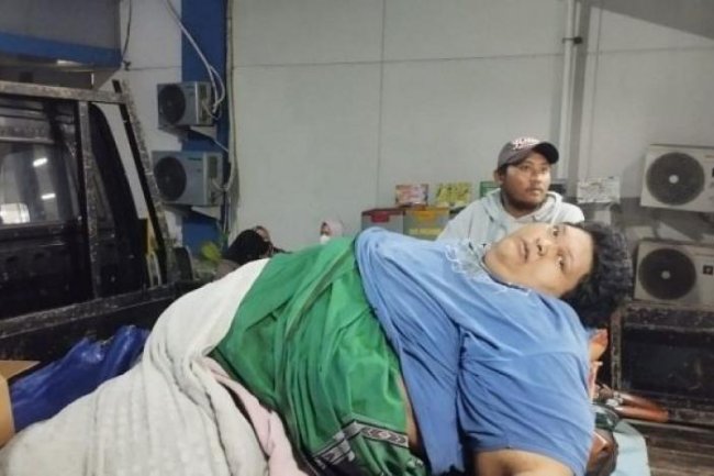 Innalillahi, Fajri yang Berbobot 300 Kg Meninggal di RSCM