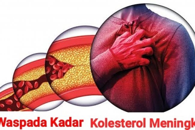 Waspadai Bahaya Kolesterol Tinggi, Hindari Minuman Ini untuk Kurangi Resiko, Salah Satunya Mengandung Kafein