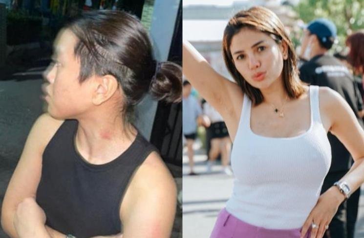 Foto Cupang di Leher Laura Meizani Diumbar Nikita Mirzani: Ini Alasan Mimi Kunciin Kamu