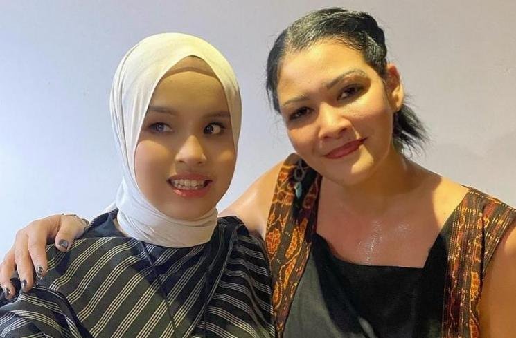 Beda Perlakuan Sebelum dan Sesudah Putri Ariani Sukses di AGT Dibongkar Melanie: Gak 1-2 Orang Bilang Kasihan