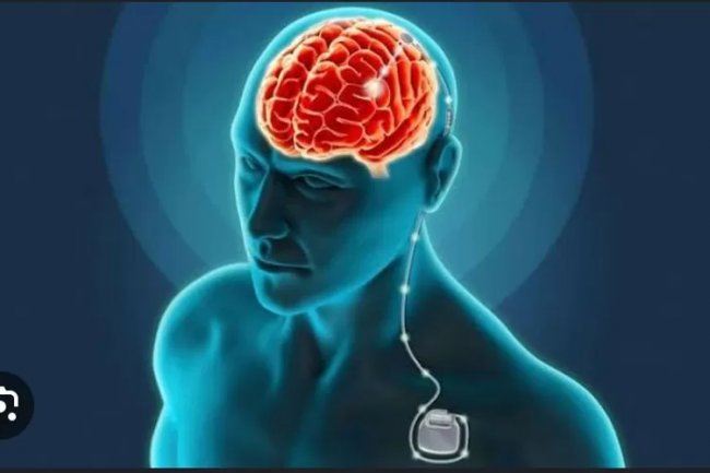Mengenal Metode DBS untuk Pasien Parkinson, Kualitas Hidup Lebih Tinggi