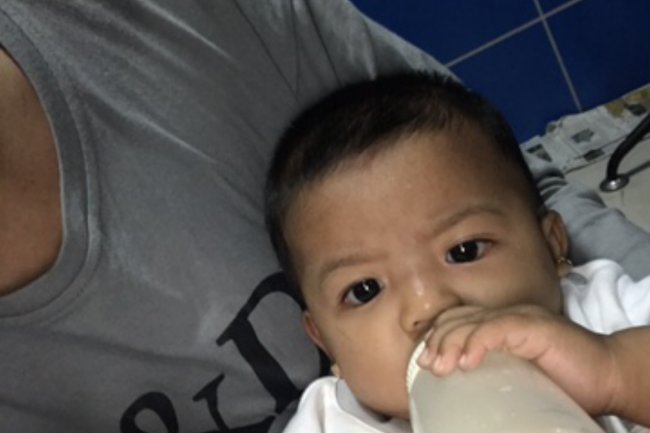Anak Alergi Susu Sapi, Ini Alternatif Aman Pengganti Susu Sapi. Simak Penjelasannya!.