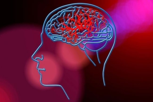 Dokter Jelaskan Teknik Akurat untuk Diagnosis dan Pengobatan Tumor Otak