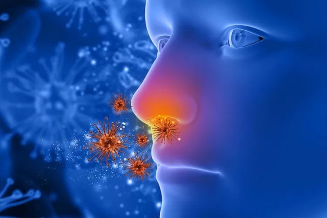 7 Cara Mudah Terhindar dari Sinusitis, Salah Satunya Makan Makanan Bergizi