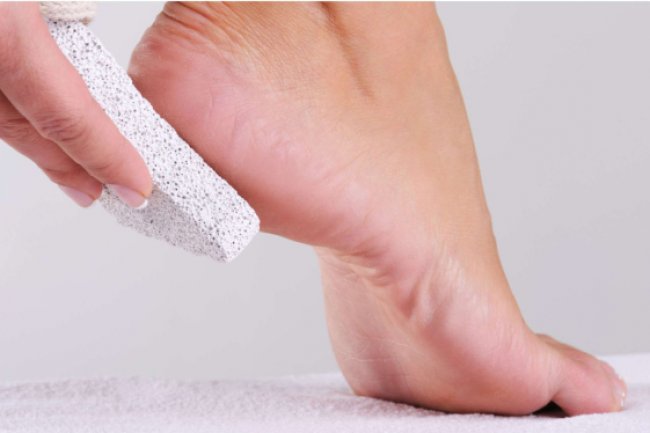 Ini Dia Tips Mencegah Kaki Lecet saat Memakai Sepatu Baru