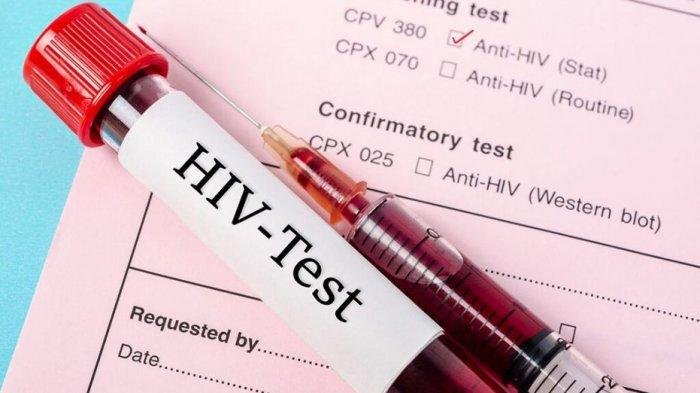 Update Kasus HIV/AIDS di Ambon: Ada 174 Kasus Baru Kurun Waktu 7 Bulan