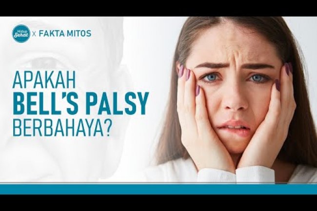 Mirip Gejala Stroke, Apakah Bell's Palsy Penyakit Berbahaya?
