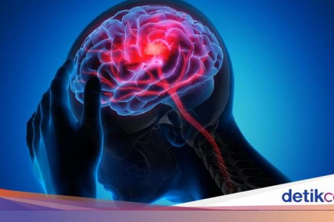 Apakah Sering Mengorok gegara Ada Pembuluh Darah Pecah Berbahaya, Dok?